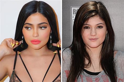 kylie jenner vorher nachher bilder|Kylie Jenner’s Transformation – Her Face & Body。